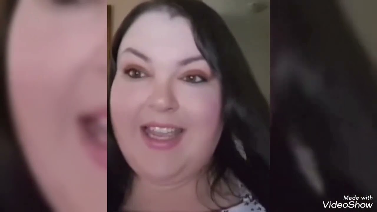 Bald Spot Confidence: Covering Techniques & Emotional Healing