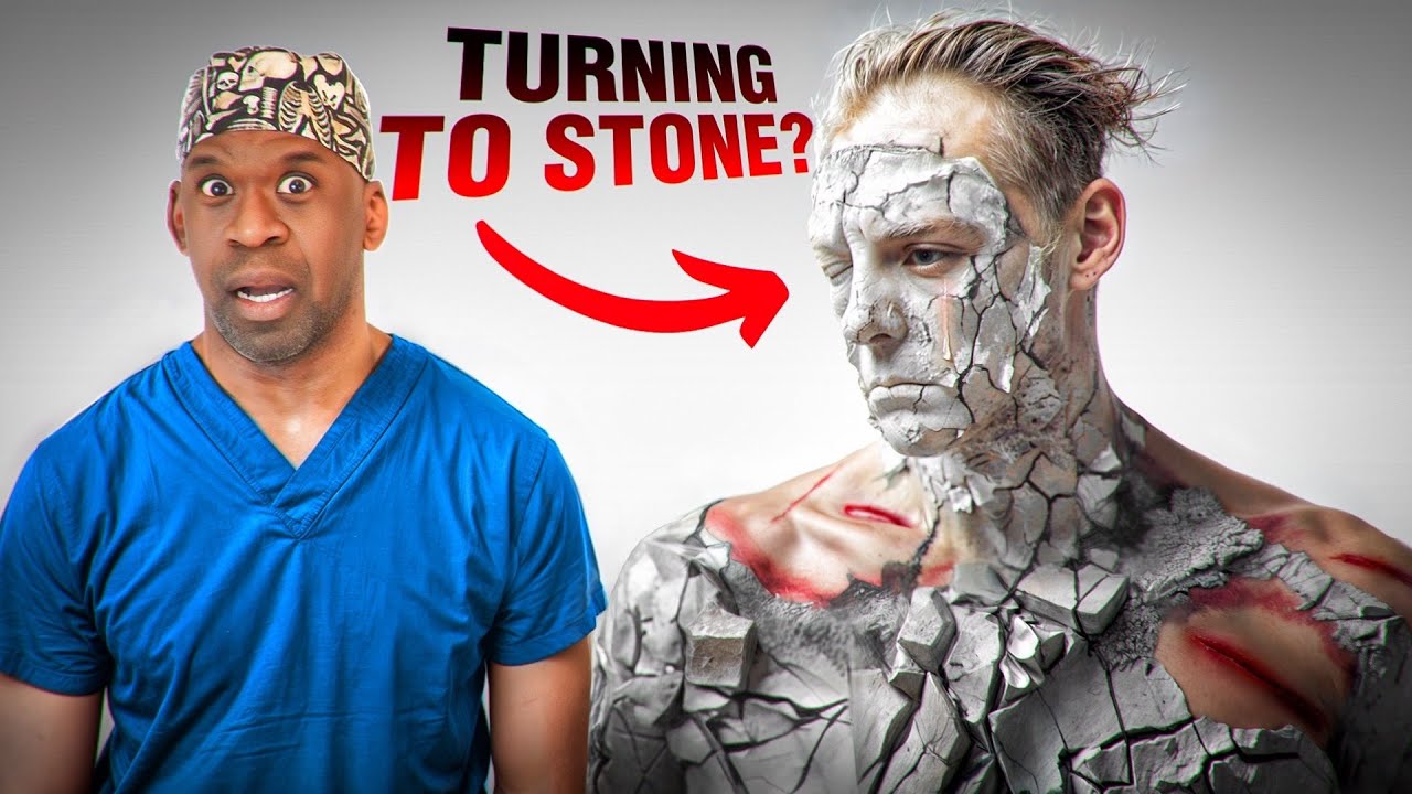 5 Rarest Diseases Explained: Symptoms, Causes & Hope