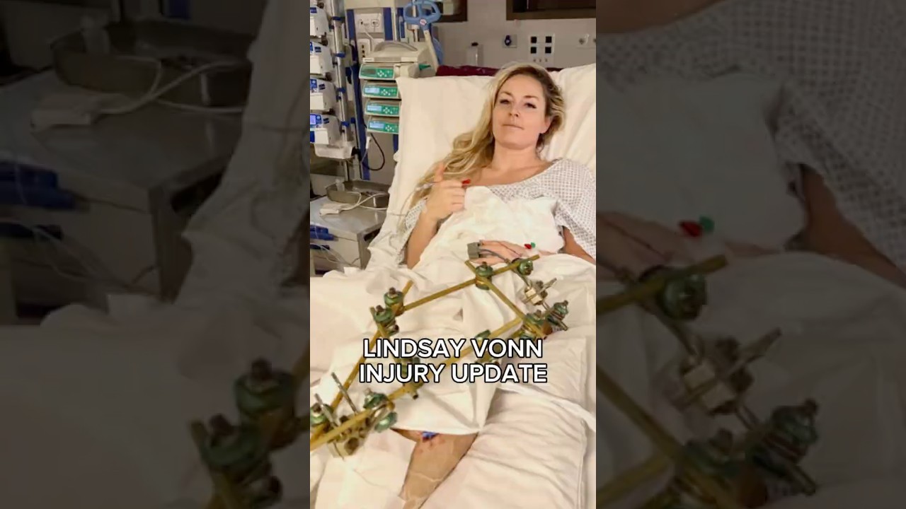 Lindsey Vonn Knee Injury Recovery: Why Multiple Surgeries Are Crucial
