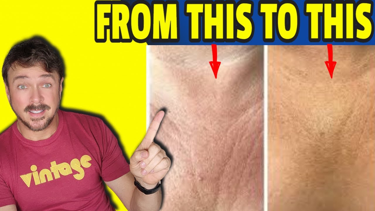 Reverse Chest Wrinkles: Dermatologist-Approved 4-Step Method