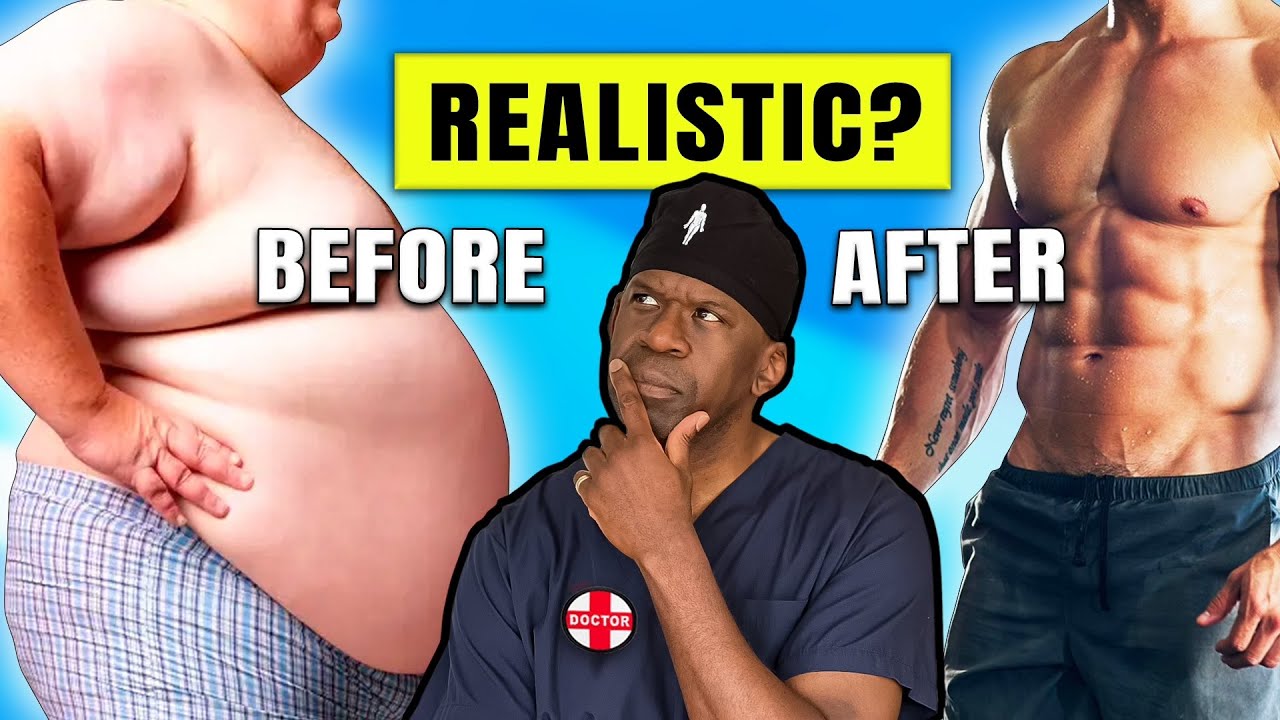 Obesity Treatment Insights: Privilege, Realism, and Effective Strategies