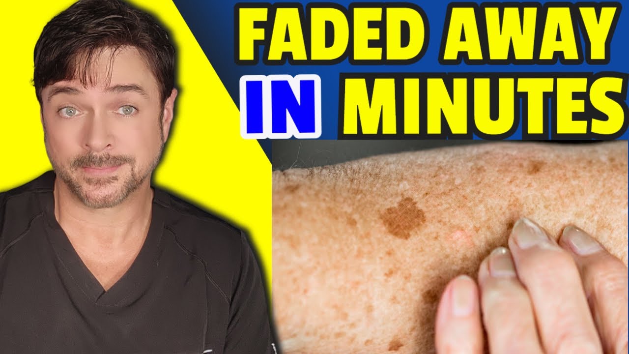 How to Fade Dark Spots Fast: 3 Proven Steps from a Skincare Expert