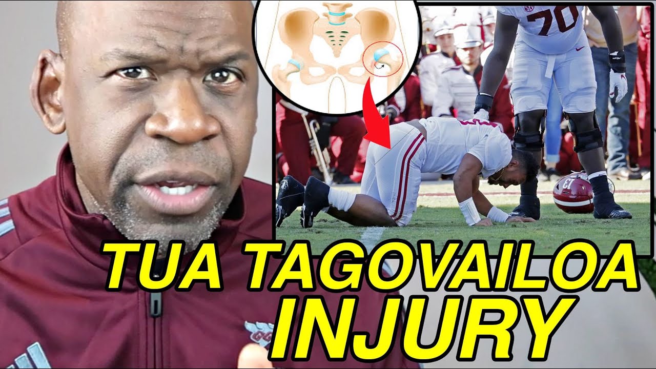 Tua Tagovailoa Hip Injury: Diagnosis, Surgery & NFL Future