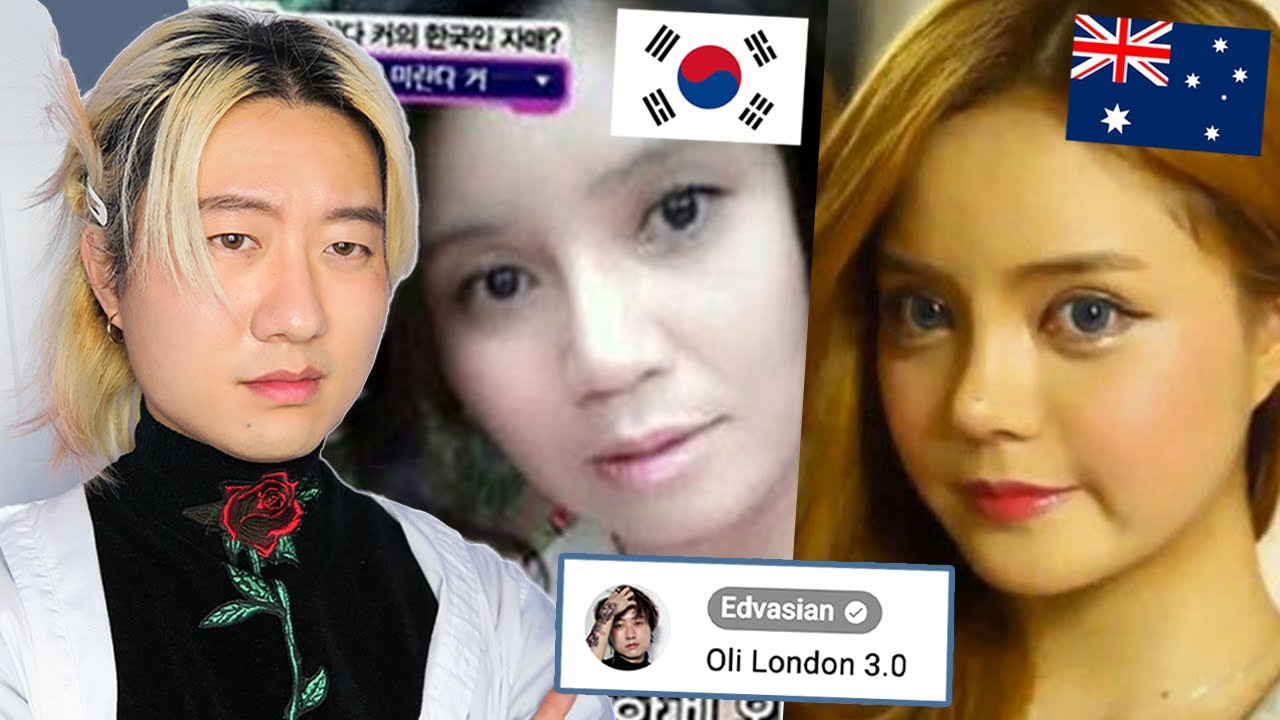 Korean Model's Miranda Kerr Plastic Surgery: Race Change Debate