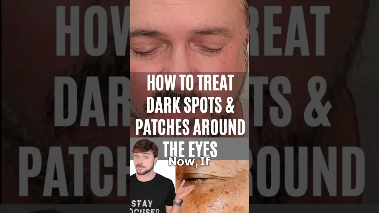 Turmeric Serum for Dark Spots: Quick Fix for Hyperpigmentation