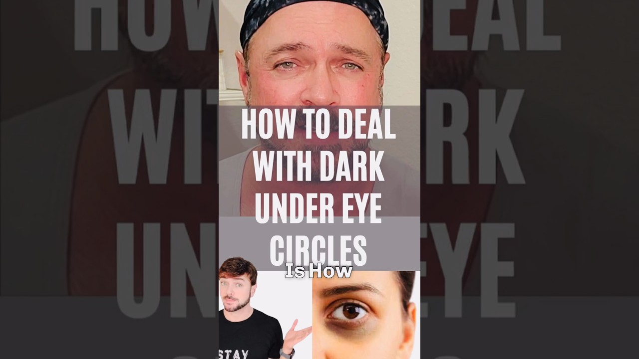 Dark Circles Solution: Expert Tips & Caffeine Serum Guide