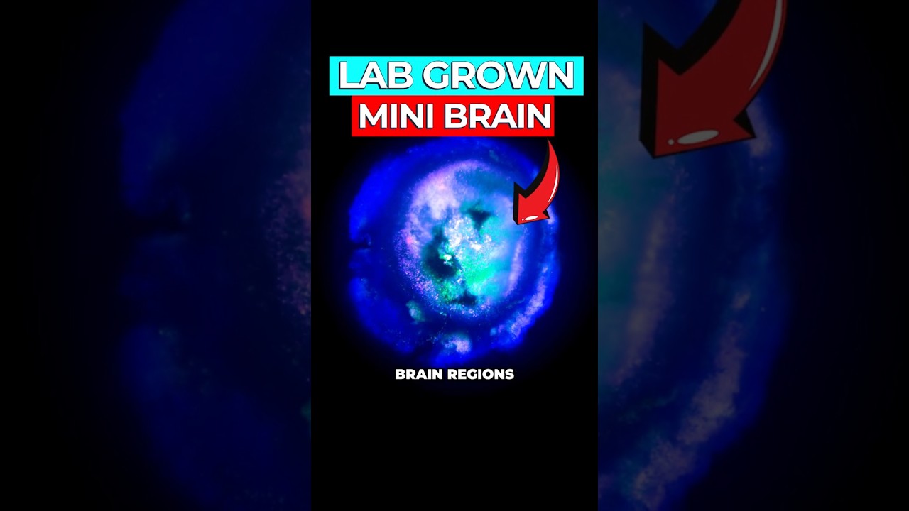 Multi-Region Brain Organoids: Neuroscience Breakthrough Explained