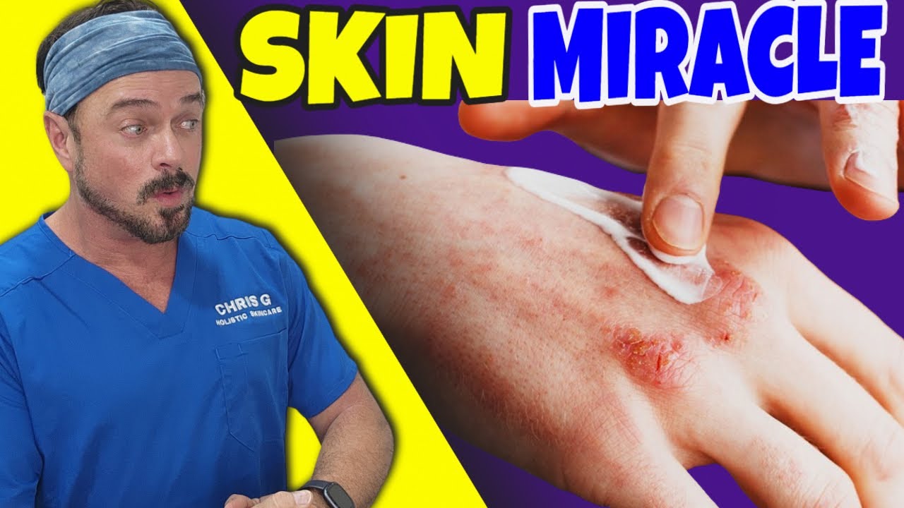 Protect Your Hands from Damage: Expert Skin Shielding Guide