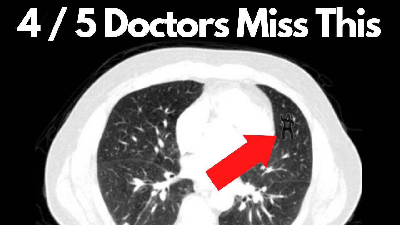 AI Reduces Radiologist Workload: First Autonomous Medical Imaging Cleared