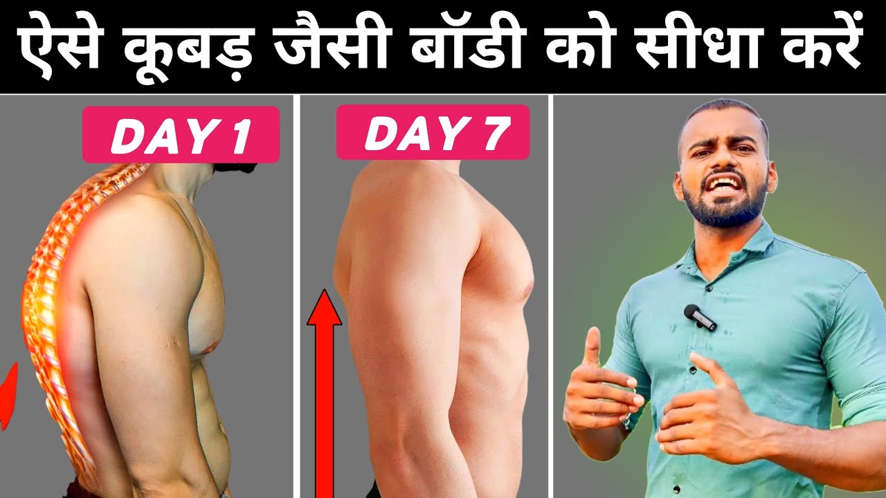 Fix Hunched Posture in 1 Week: Expert-Backed Methods