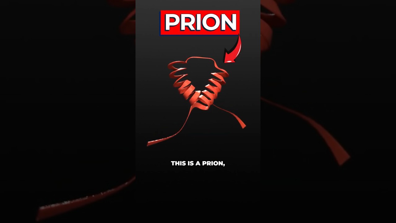 Fatal Familial Insomnia: When Genetic Mutation Steals Sleep