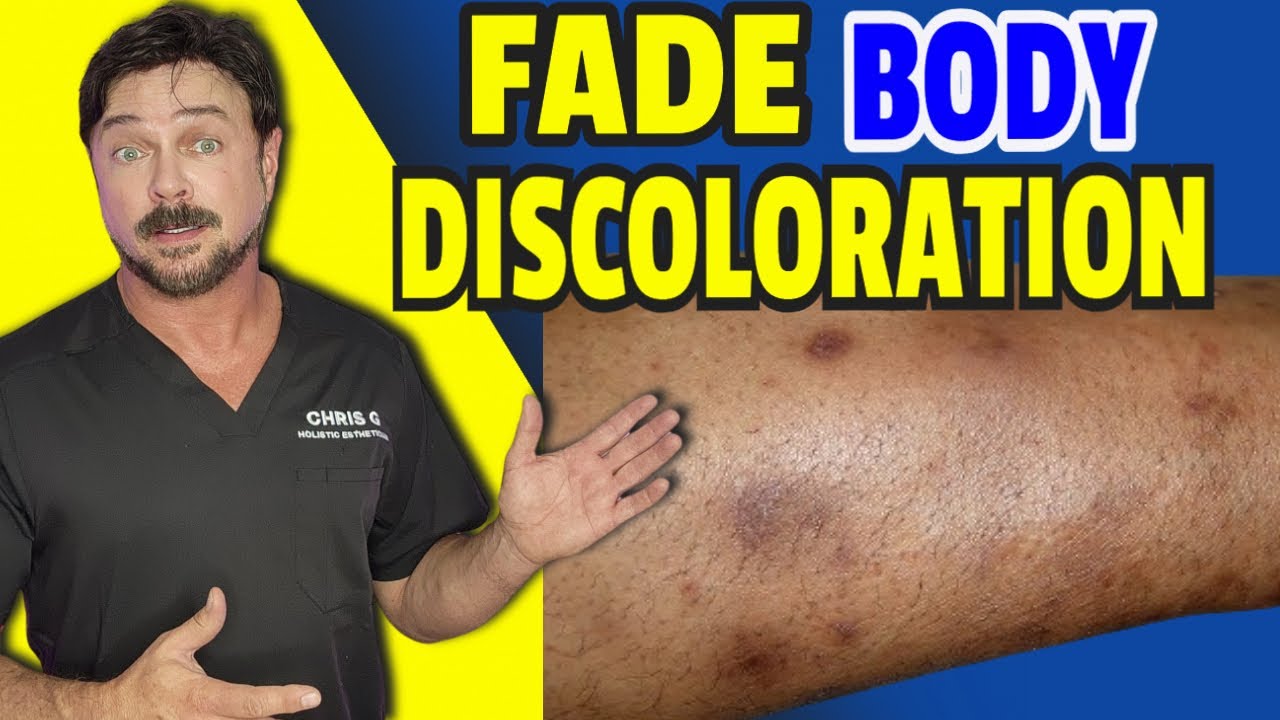 Turmeric for Dark Spots: Safe Sensitive Skin Solutions