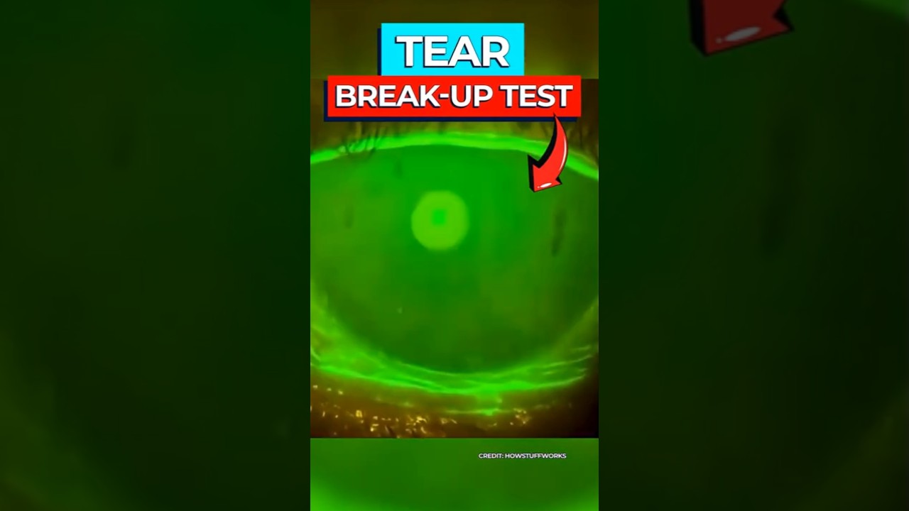 Why Your Eyes Feel Dry: The Science of Tear Film Protection