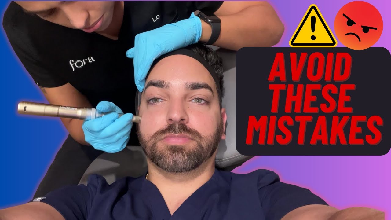 5 Critical Microneedling Mistakes to Avoid for Healthy Skin