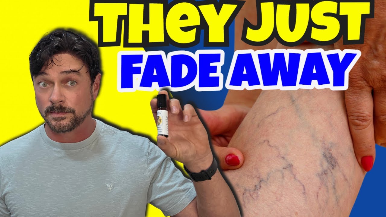 Helichrysum Oil for Spider Veins: Proven Natural Solution