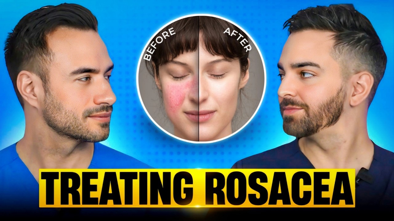Rosacea Types & Treatments: Dermatologist Guide 2024