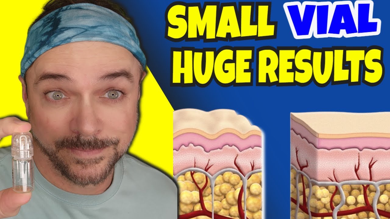 Cure Microinfusion Holiday Bundle: Anti-Aging Home Treatment Guide