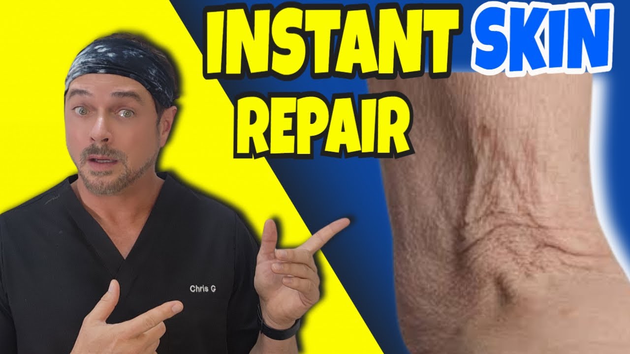 Fix Crepey Skin Fast: Anti-Aging Routine & Diet Tips