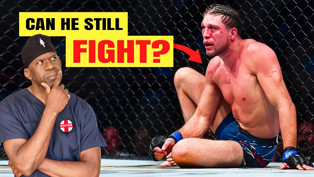 Failed Shoulder Surgery? Advanced Solutions for Recurrent Dislocations