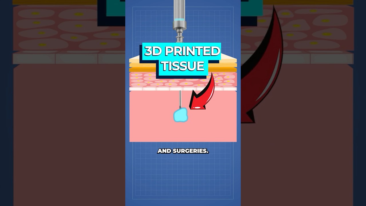 Internal 3D Printing for Targeted Medicine Delivery