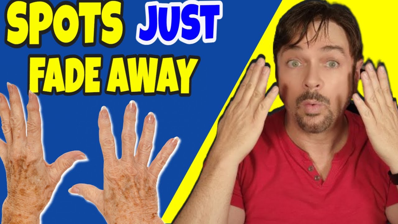 Natural Oils That Fade Dark Spots: Expert Guide