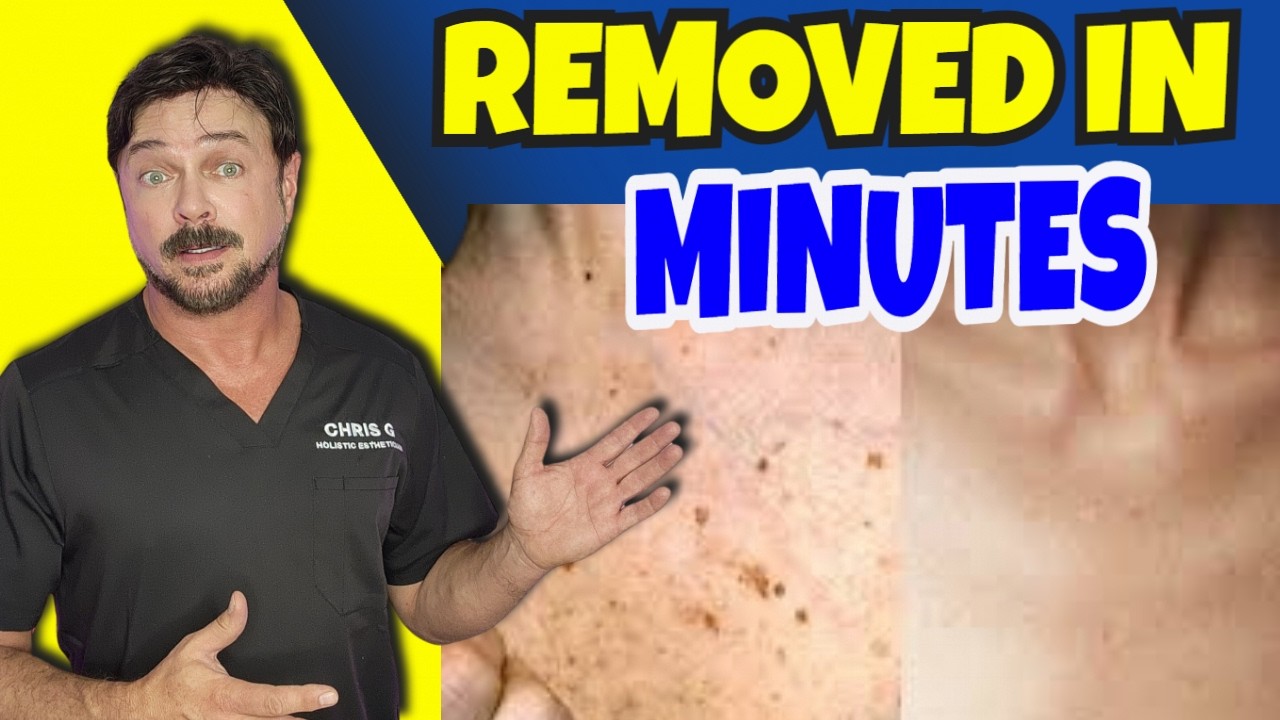 How to Reduce Age Spots Naturally: Dermatologist-Approved Methods