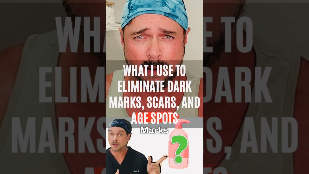 How to Fade Dark Spots & Even Skin Tone Naturally