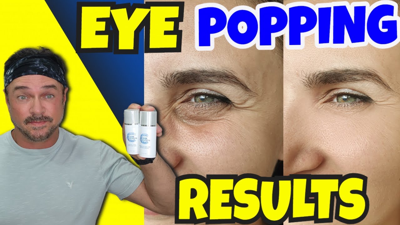 Transform Your Eye Area: Anti-Aging Bundle Review & Guide