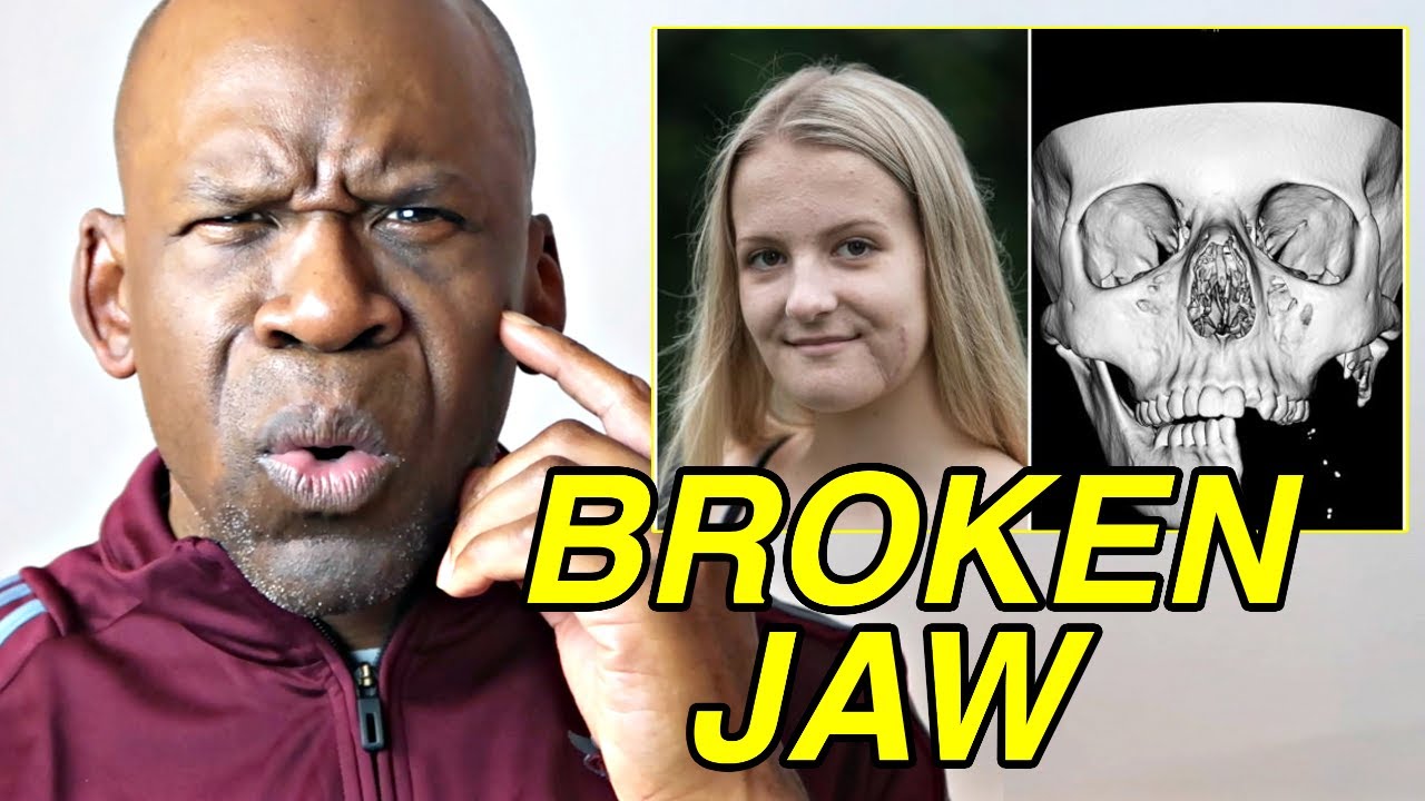 Severe Facial Trauma Recovery: Equestrian Accident Case Study