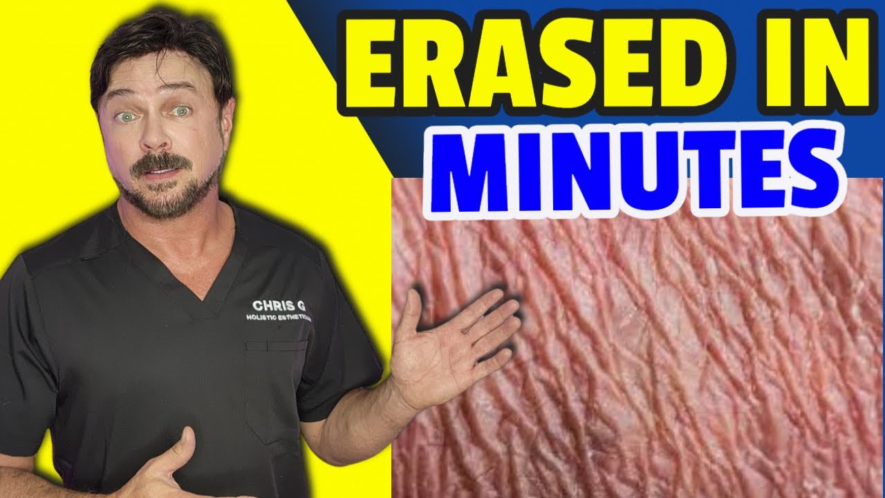 Reverse Crepey Skin: 2 Simple Steps for Instant Results