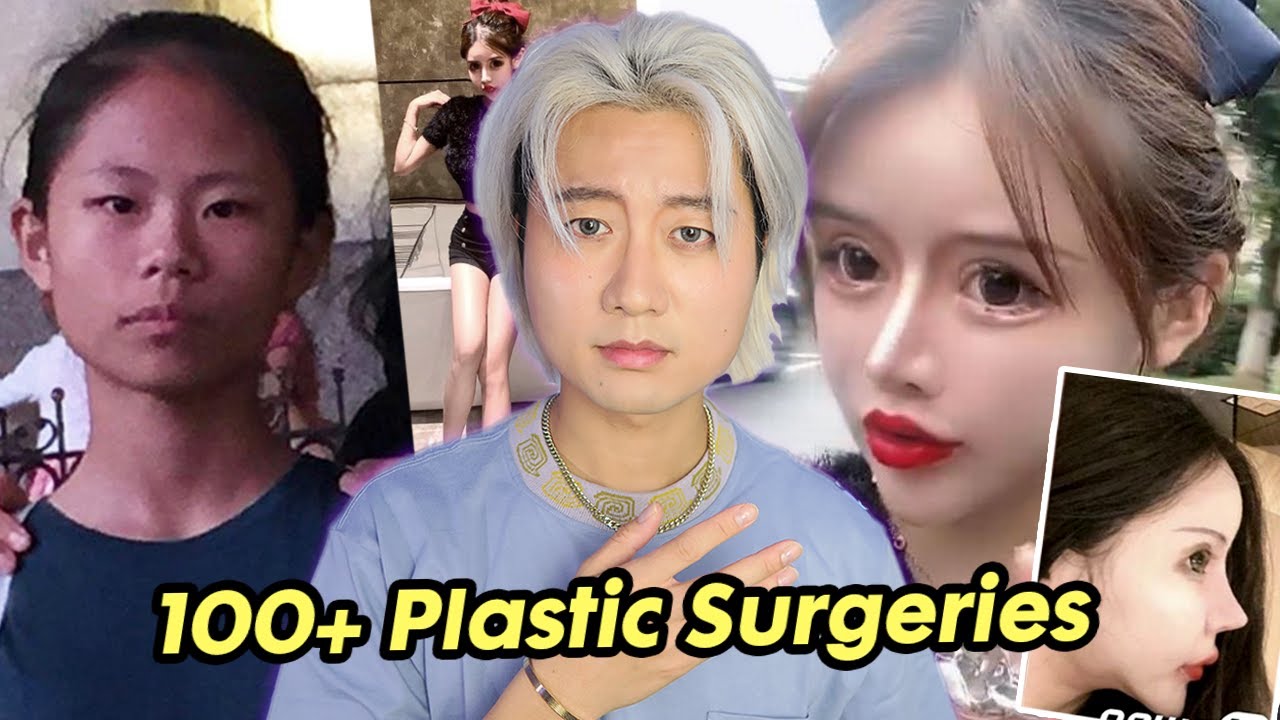 Teen Plastic Surgery Epidemic: Ethics, Risks & Beauty Standards