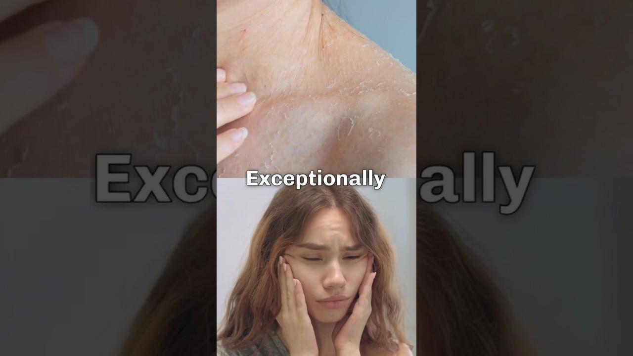 Frankincense Myrrh Sandalwood Oil: Reduce Neck Aging Naturally