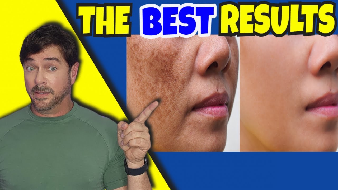 Fade Dark Spots Fast: Proven Duo for Hyperpigmentation