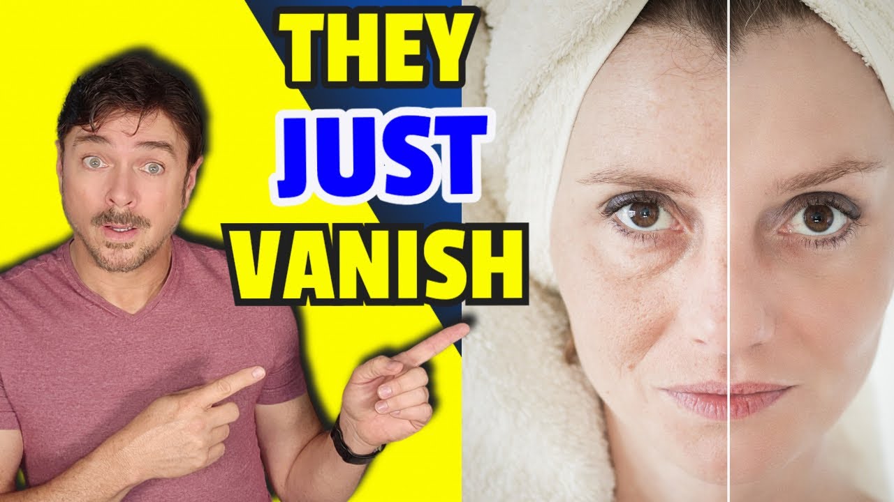 Vanishing Act Line Filler: Instant Wrinkle Blurring & Skin Tightening