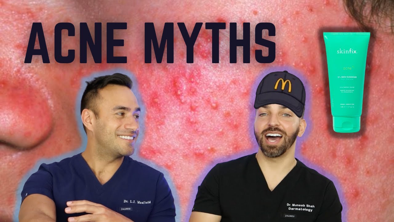 Top Acne Myths Debunked by Dermatologists: Evidence-Based Facts