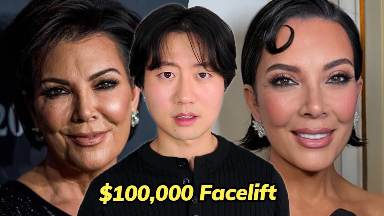 Instagram Face Phenomenon: Why Everyone Looks the Same Now