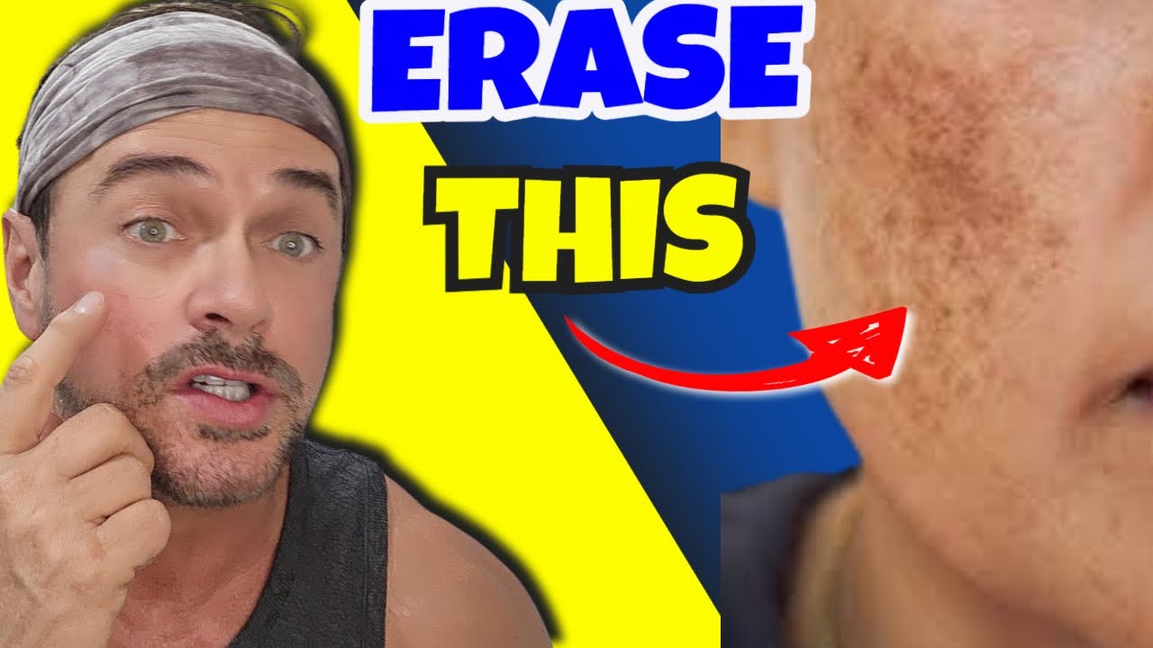 How to Fade Dark Spots & Scars Naturally at Any Age