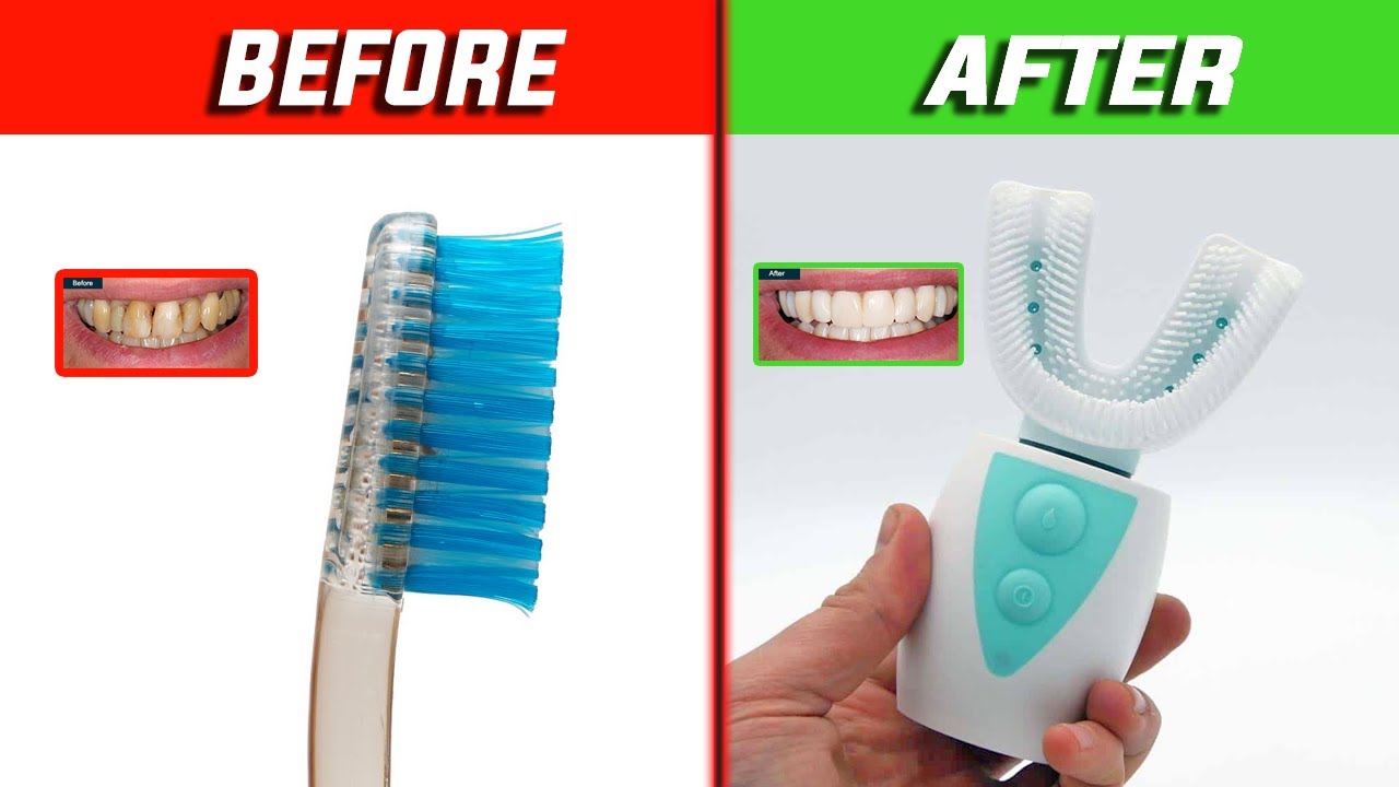 title:10 Affordable Useful Gadgets Under 15K Rupees For Daily Life