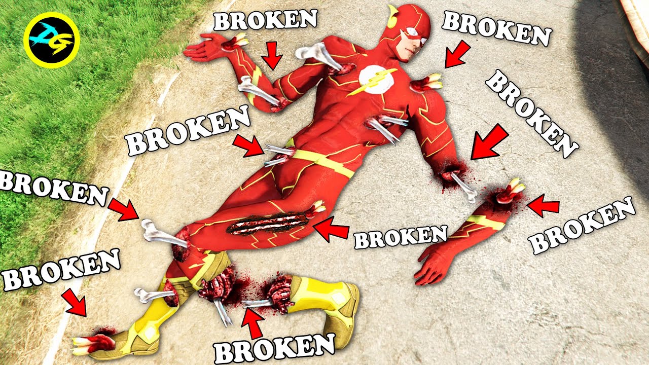 Bone Fracture Science: How Impacts Break Human Skeletons