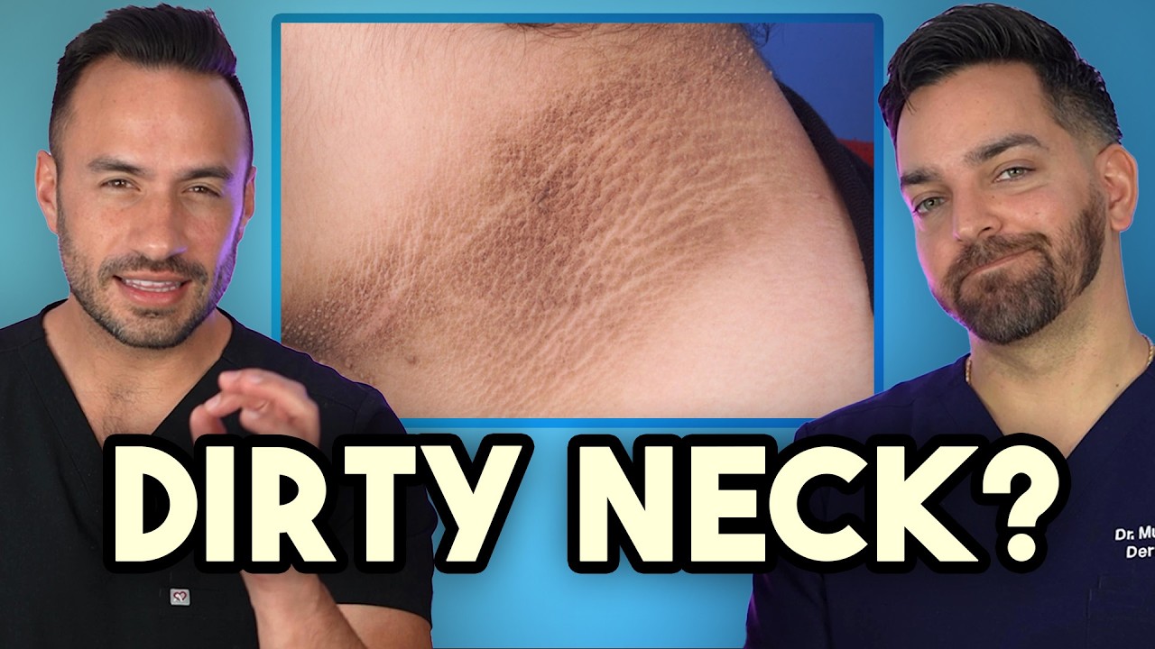 Acanthosis Nigricans: Dark Neck Causes & Treatments
