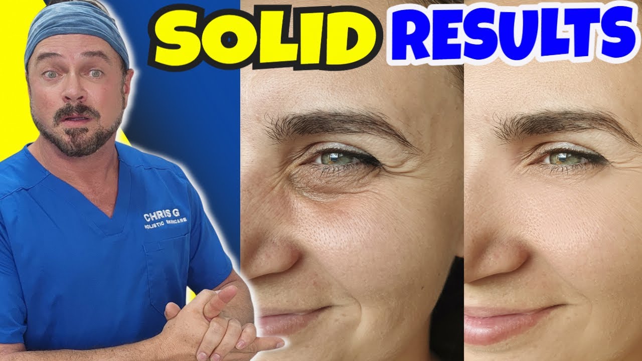 Bakuchiol: Gentle Retinol Alternative for Youthful Skin