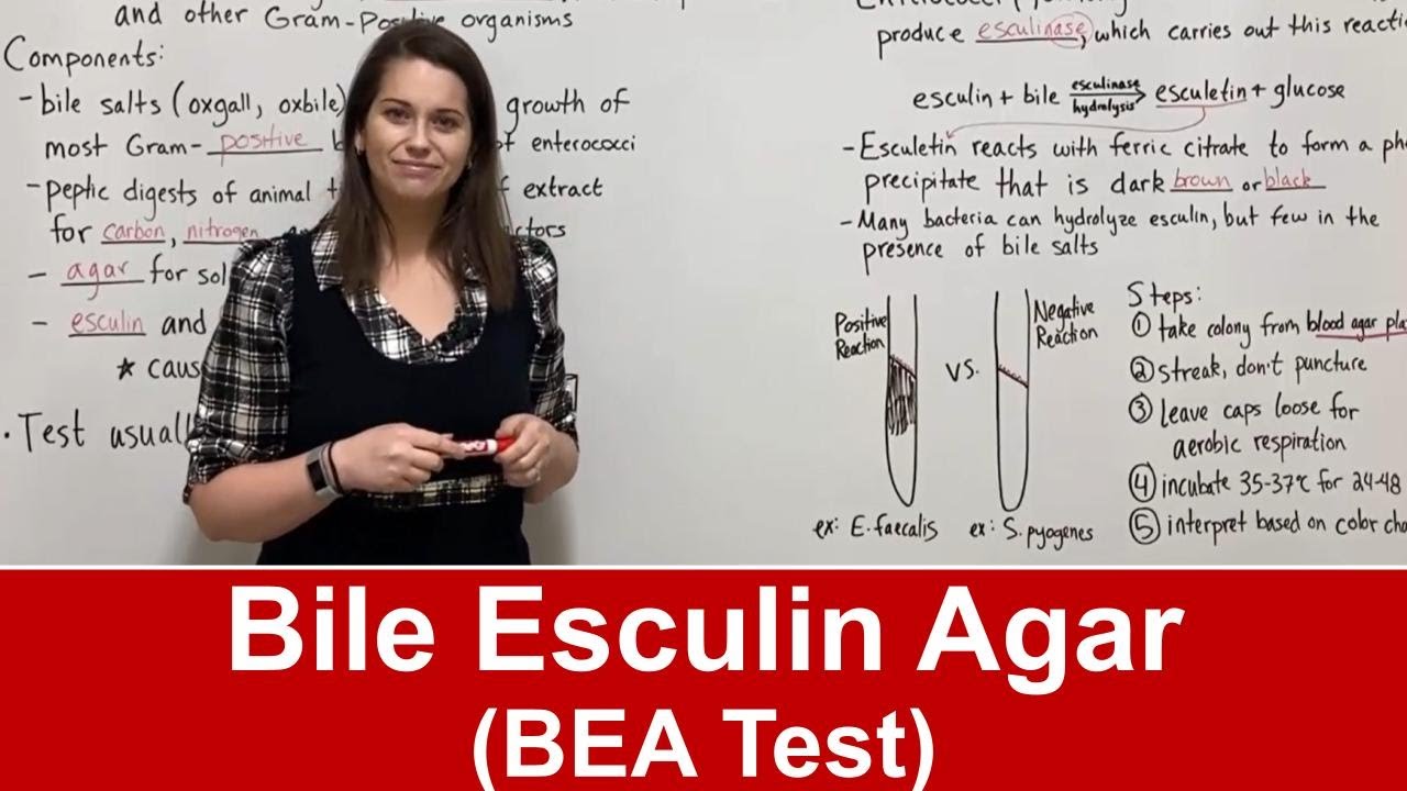 Bile Esculin Test Guide: Procedure & Interpretation Explained