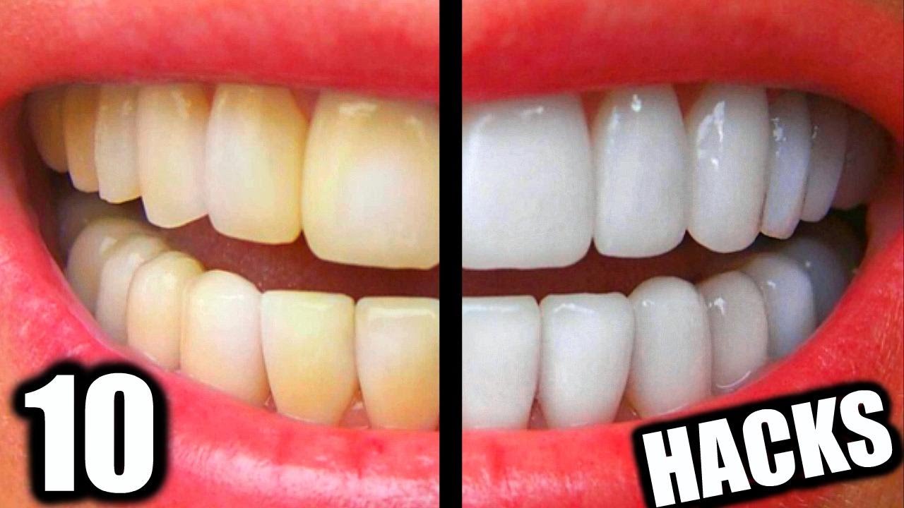 10 Safe DIY Teeth Whitening Methods Backed by Home Testing
