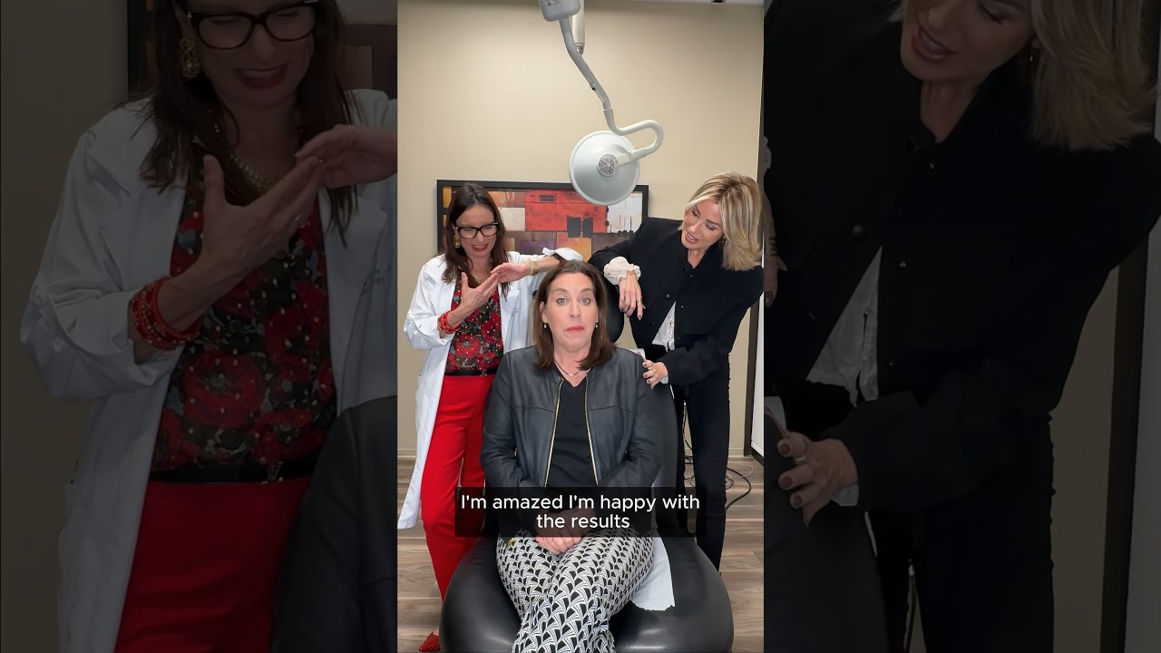 CoolSculpting Elite Results: Real Patient Transformation at 50+