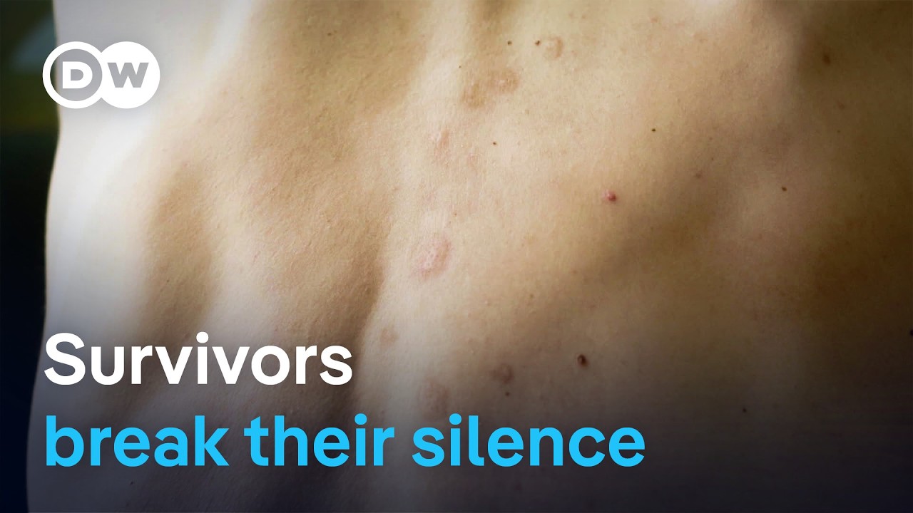 Male War Rape Survivors Break Silence: Justice Challenges