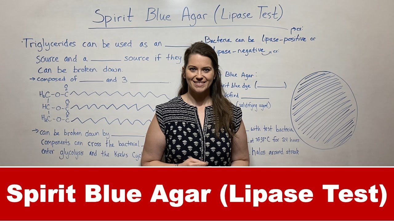 Spirit Blue Agar Lipase Test: Step-by-Step Guide & Results