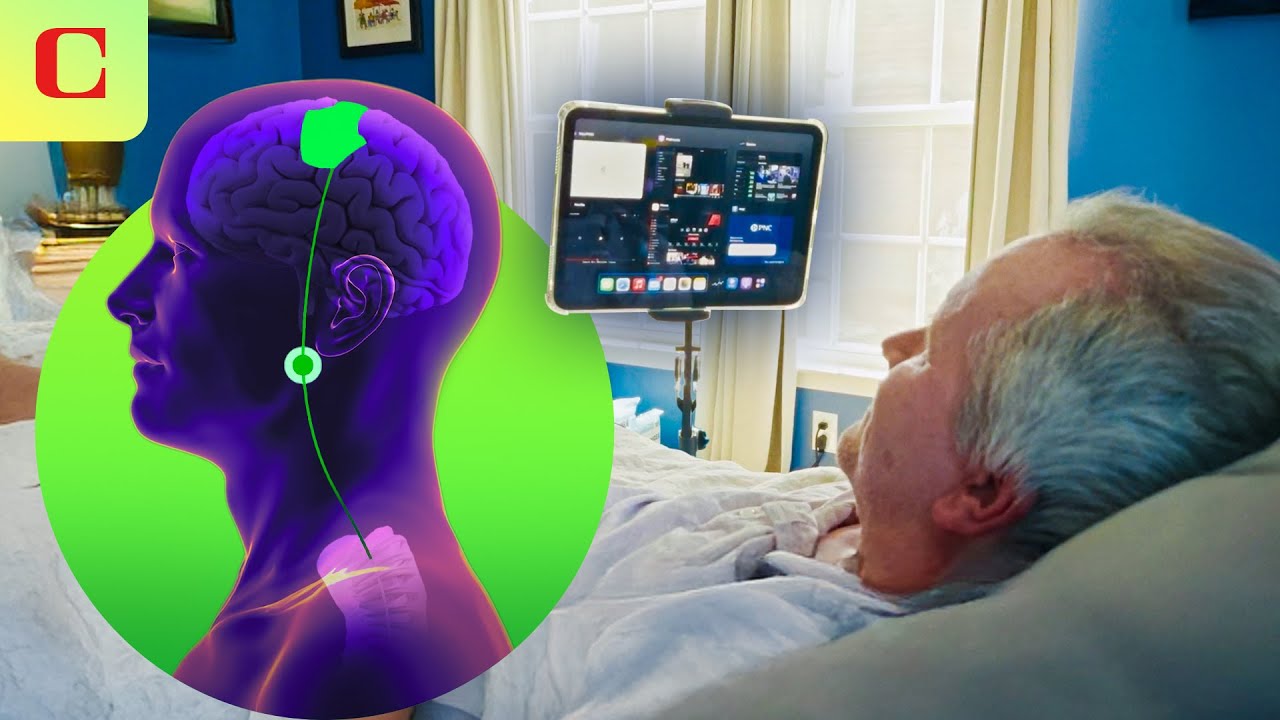 Synchron vs Neuralink: BCI Tech Compared