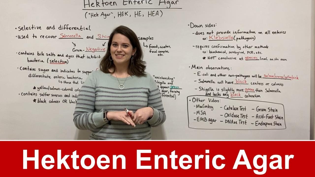 Decoding Hektoen Enteric Agar: Salmonella & Shigella Identification