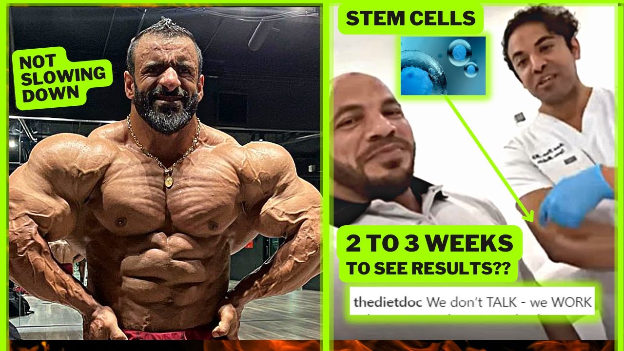 Big Ramy's Stem Cell Therapy: Arnold Classic Comeback Strategy