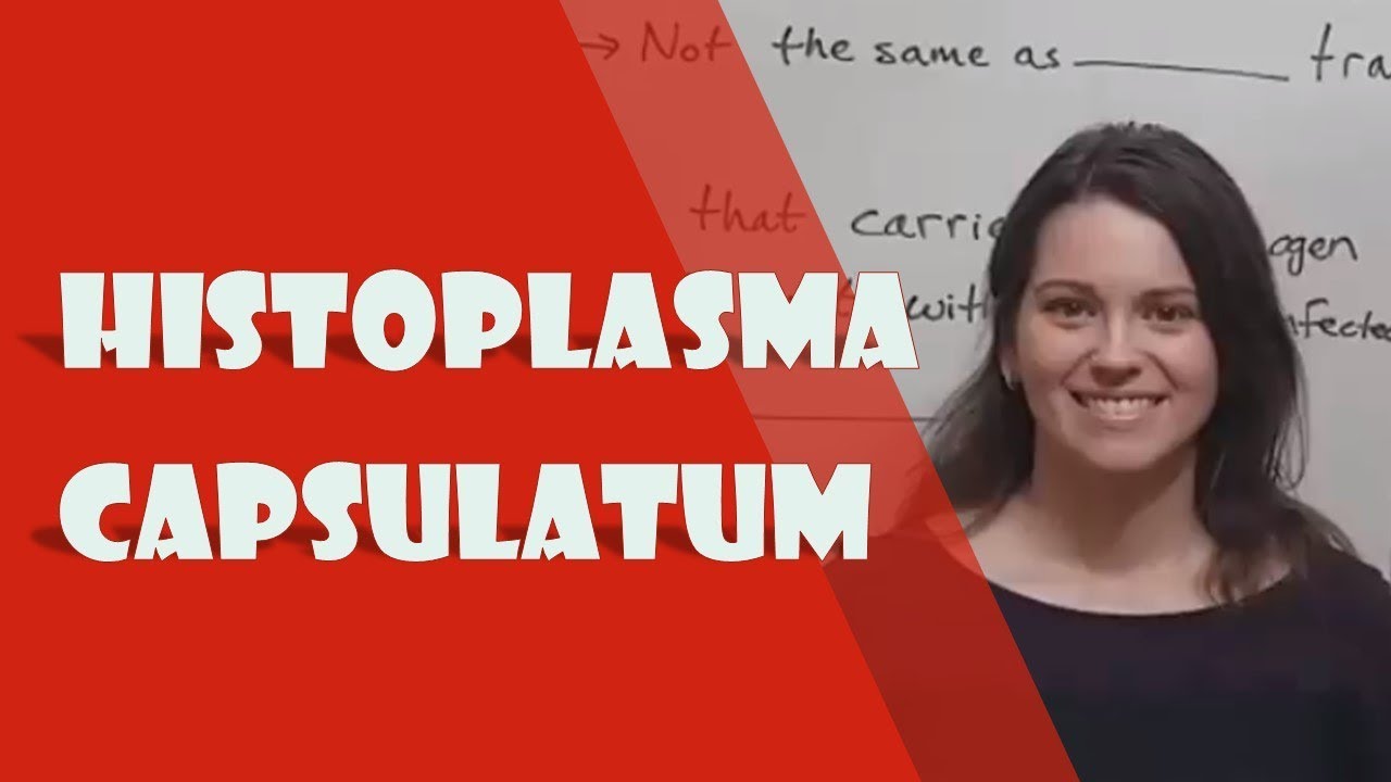 Histoplasma Infection: How Fungal Spores Cause Human Disease